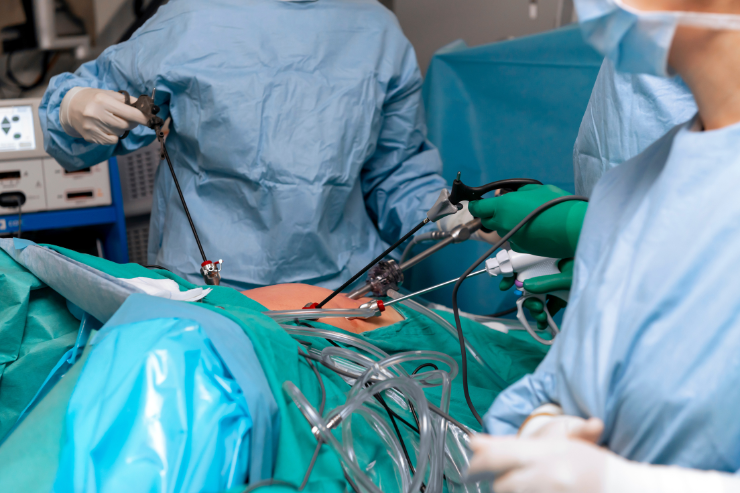 Laparoscopic Surgery